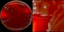 <p><strong>Fig. 73:1.</strong> Cultivation of <i>Proteus vulgaris</i>, strain SLV 476, on a blood agar plate for 24 h at 37°C. Arrows point to one area where a colony is beginning to form, however, the bacteria are quickly spreading out a on the agar surface, because <i>P. vulgaris</i> swarms. The lengths of the scale bars are equivalent to 1 cm. The right image is a magnification of a part of the left one. Arrows point to the same colony. Date: 2013-12-25.</p>

<p> </p>