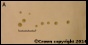 <p><strong>Fig. 38:1.</strong> Colonies of <em>Mycoplasma mycoides</em> subsp. <em>mycoides</em>, strain Gladysdale, cultivated on Eaton's agar under 2 days (A) and 4 days (B), respectively at 37°C and in the presence of 5% CO<sub>2</sub>. The total length of the scale bars is equivalent to 0.5 mm. Date: 2014-01-28.</p>

<p> </p>