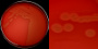 <p><b>Fig. 60:1.</b> Colonies of <i>Mannheimia haemolytica</i>, strain PAT 4483/10, after cultivation on <strong>bovine blood agar</strong> during 24 h at 37°C. It is much easier to observe the hemolysis on bovine blood agar than on horse blood agar. The plate was photographed with light from below. A, the whole plate. B, close-up of A. The length of the scale bar is equivalent to 1 cm and 5 mm, respectively. Date: 2014-10-22.</p>

<p> </p>