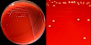 <strong>Fig. 17:1.</strong> A. Colonies of <i>Streptococcus dysgalactiae</i> subsp. <i>dysgalactiae</i> cultivated on bovine blood agar at 37 °C during 24 h. The agar plate was photographed <strong>with light from above</strong>. B. Close-up of some colonies from the agar plate to the left. Here the weak α-hemolysis is visible, but it is more easily observed with light from below (see Fig. 17:2). The total length of the scale bars is equivalent to 1 cm and 5 mm, respectively. Date: 2014-11-14.</p>