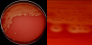 <p><strong>Fig. 14:2.</strong> Image A. Colonies of <i>Streptococcus equi</i> subsp. <i>equi</i> cultivated on bovine blood agar at 37 °C during 48 h. The agar plate was photographed <strong>with light from below</strong>. Image B. Close-up of some colonies from the agar plate to the left. The clear β-hemolysis is visible in both panels. The total length of the scale bars is equivalent to 1 cm and 3 mm, respectively. Date: 2014-11-19.</p>

<p> </p>