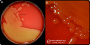 <p><strong>Fig. 14:1.</strong> Image A. Colonies of <i>Streptococcus equi</i> subsp. <i>equi</i> cultivated on bovine blood agar at 37 °C during 48 h. The agar plate was photographed <strong>with light from bellow</strong>.  Image B. Close-up of some colonies from the agar plate to the left. The β-hemolysis is difficult to see, but it is more easily observed with light from below. The total length of the scale bars is equivaleent to 1 cm and 3 mm, respectively. Date: 2022-01-23.</p>

<p> </p>