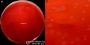 <p><strong>Fig. 139:1.</strong> Colonies of <i>Treponema phagedenis</i>, strain V1, cultivated anaerobically on an FAA plate at 37°C during 8 days. Image B is a close-up of the plate in image A. The lengths of the scale bars in A and B are equivalent to 10 and 5 mm, respectively. <strong>Lighting from above</strong> during photography. It is difficult to discern the colonies, because they are very thin. Date: 2016-03-18.</p>

<p> </p>