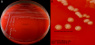 <p><strong>Fig. 109:1.</strong> Colonies of <em>Campylobacter coli</em>, strain SLV427, cultivated microaerophilcally on bovine blood agar at 37°C during 48 h. Photographed with lighting from above. A, overview of the plate; B, close-up. The lengths of the scale bars are equivalent to 10 and 5 mm, respectively. Date: 2016-05-19.</p>

<p> </p>