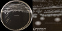 <p><strong>Fig. 109:3.</strong> Colonies of <i>Campylobacter coli</i>, strain SLV427, cultivated microaerophilically on a CCDA plate at 37°C during 48 h. A, overview of the plate; B, close-up. The lengths of the scale bars are equivalent to 10 and 5 mm, respectively. Date: 2016-05-26.</p>

<p> </p>