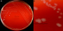 <p><strong>Fig. 144:1.</strong> Colonies of <i>Campylobacter lari</i>, strain Cb 227 - 99, cultivated microaerophilically on bovine blood agar at 37°C during 48 h. A, overview of the plate; B, close-up. The lengths of the scale bars are equivalent to 10 and 5 mm, respectively. Date: 2016-06-01.</p>

<p> </p>