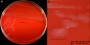 <p><strong>Fig. 110:1.</strong> Colonies of <em>Campylobacter upsaliensis</em>, strain CCUG 14913, cultivated microaerophilically on bovine blood agar at 37°C during 48 h. A, overview of the plate; B, close-up. Note that this bacterium has a tendency to swarm on bovine blood agar. The lengths of the scale bars are equivalent to 10 and 5 mm, respectively. Date: 2016-06-01.</p>

<p> </p>