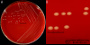 <p><strong>Fig. 103:1.</strong> Colonies of <i>Fusobacterium necrophorum</i> subsp. <i>necrophorum</i> cultivated on an FAA plate at 37°C during 48 h. Panel A shows the whole plate and panel B shows a close-up. The total length of the scale bars is equivalent to 10 and 3 mm, respectively. Date: 2016-09-08.</p>

<p> </p>