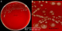 <p><strong>Fig. 26:1.</strong> Colonies of <i>Clostridioides difficile</i>, cultivated anaerobically on a FAA plate at 37°C during 48 h. Panel A shows the whole plate and panel B shows a close-up, where the irregular and somewhat diffuse colonies can be observed. The total length of the scale bars are 10 and 5 mm, respectively. Date: 2016-09-08.</p>

<p> </p>