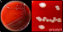 <p><strong>Fig. 107:1.</strong> Colonies of <i>Actinobacillus equuli</i> subsp. <i>equuli</i>, strain CCUG 2041, cultured aerobically on bovine blood agar at 37°C during 24 h. Image A shows the whole plate and image B shows an enlargement of the plate. The total length of the scale bars are equivalent to 10 and 3 mm, respectively. Date: 2016-10-06.</p>

<p> </p>