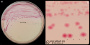 <p><strong>Fig. 77:3.</strong> Colonies of <i>Yersinia enterocolitica</i> subsp. <i>enterocolitica</i>, strain 45643, cultivated on <a href="http://www.vetbact.org/?displayextinfo=107" target="_blank"><b>CIN-agar</b></a> during 24 h at 30°C. Image B is a close-up of image A. Note the appearance of the colonies (so-called "bull's eye") on CIN agar. The lengths of the scale bars corresponds to 1 cm and 3 mm, respectively. Date: 2016-10-25.</p>

<p> </p>