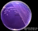 <p><strong>Fig. 71:4.</strong> Colonies of <i>Plesiomonas shigelloides</i> cultivated on purple agar at 37 °C during 24 h. The length of the scale bar is equivalent to 1 cm. Date: 2016-11-02.</p>

<p> </p>