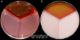 <p><b>Fig. 19:5.</b> <i>Streptococcus uberis</i> cultivated on a SELMA plate at 37°C during 24 h. Note that <i>S. uberis</i> is only growing in sector 1 (blood agar with esculine). Image A was photographed with lighting from above and image B with lighting from below. The hemolysis is most clearly visible in image B. The cultivation media in the other sectors are given in the media list under <a href="/index.php?displayextinfo=43" target="_blank">SELMA plate</a>. <i>S. uberis</i> has only a weak esculinase activity and it is, therefore, difficult to see that it is actually esculinase positive. Date: 2017-06-07.</p>

<p> </p>
