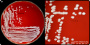 <p style="color: rgb(0, 0, 0); font-family: sans-serif; font-size: 16px; font-style: normal; font-variant: normal; font-weight: 400; letter-spacing: normal; orphans: 2; text-align: left; text-decoration: none; text-indent: 0px; text-transform: none; -webkit-text-stroke-width: 0px; white-space: normal; word-spacing: 0px;"><strong style="color: rgb(0, 0, 0); font-family: sans-serif; font-size: 16px; font-style: normal; font-variant: normal; font-weight: 700; letter-spacing: normal; orphans: 2; text-align: left; text-decoration: none; text-indent: 0px; text-transform: none; -webkit-text-stroke-width: 0px; white-space: normal; word-spacing: 0px;">Fig 258:1.</strong><span style="background-color: rgb(221, 221, 221); color: rgb(0, 0, 0); display: inline; float: none; font-family: sans-serif; font-size: 16px; font-style: normal; font-variant: normal; font-weight: 400; letter-spacing: normal; orphans: 2; text-align: left; text-decoration: none; text-indent: 0px; text-transform: none; -webkit-text-stroke-width: 0px; white-space: normal; word-spacing: 0px;"> </span><span style="background-color: rgb(221, 221, 221); color: rgb(0, 0, 0); display: inline; float: none; font-family: sans-serif; font-size: 16px; font-style: normal; font-variant: normal; font-weight: 400; letter-spacing: normal; line-height: 1.5em; orphans: 2; text-align: left; text-decoration: none; text-indent: 0px; text-transform: none; -webkit-text-stroke-width: 0px; white-space: normal; word-spacing: 0px;">Colonies of </span><span style="display: inline !important; float: none; background-color: rgb(221, 221, 221); color: rgb(0, 0, 0); font-family: sans-serif; font-size: 16px; font-style: normal; font-variant: normal; font-weight: 400; letter-spacing: normal; line-height: 1.5em; orphans: 2; text-align: left; text-decoration: none; text-indent: 0px; text-transform: none; -webkit-text-stroke-width: 0px; white-space: normal; word-spacing: 0px;"><em>Staphylococcus saprophyticus</em> subsp. <em>saprophyticus</em></span><span style="background-color: rgb(221, 221, 221); color: rgb(0, 0, 0); display: inline; float: none; font-family: sans-serif; font-size: 16px; font-style: normal; font-variant: normal; font-weight: 400; letter-spacing: normal; orphans: 2; text-align: left; text-decoration: none; text-indent: 0px; text-transform: none; -webkit-text-stroke-width: 0px; white-space: normal; word-spacing: 0px;">, </span><span style="background-color: rgb(221, 221, 221); color: rgb(0, 0, 0); display: inline; float: none; font-family: sans-serif; font-size: 16px; font-style: normal; font-variant: normal; font-weight: 400; letter-spacing: normal; line-height: 1.5em; orphans: 2; text-align: left; text-decoration: none; text-indent: 0px; text-transform: none; -webkit-text-stroke-width: 0px; white-space: normal; word-spacing: 0px;">cultured aerobically on bovine blood agar at 37°C during 48 h.<span style="background-color: rgb(221, 221, 221); color: rgb(0, 0, 0); display: inline; float: none; font-family: sans-serif; font-size: 16px; font-style: normal; font-variant: normal; font-weight: 400; letter-spacing: normal; orphans: 2; text-align: left; text-decoration: none; text-indent: 0px; text-transform: none; -webkit-text-stroke-width: 0px; white-space: normal; word-spacing: 0px;"> </span>The length of the scale bars in A is equivalent to 1 cm and in B 3 mm.</span><span style="background-color: rgb(221, 221, 221); color: rgb(0, 0, 0); display: inline; float: none; font-family: sans-serif; font-size: 16px; font-style: normal; font-variant: normal; font-weight: 400; letter-spacing: normal; orphans: 2; text-align: left; text-decoration: none; text-indent: 0px; text-transform: none; -webkit-text-stroke-width: 0px; white-space: normal; word-spacing: 0px;">Datum: 2020-07-03.</span></p>

<p style="color: rgb(0, 0, 0); font-family: sans-serif; font-size: 16px; font-style: normal; font-variant: normal; font-weight: 400; letter-spacing: normal; orphans: 2; text-align: left; text-decoration: none; text-indent: 0px; text-transform: none; -webkit-text-stroke-width: 0px; white-space: normal; word-spacing: 0px;"> </p>