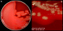 <p><strong>Fig. 103:2.</strong> Colonies of <i>Fusobacterium necrophorum</i> subsp. <i>necrophorum</i>, strain CCUG 9994, cultivated on an FAA plate at 37°C during 48 h. Note that this strain gives hemolysis on FFF plates in contrast to the strain used in Fig. 103:1. Panel A shows the whole plate and panel B shows a close-up. The total length of the scale bars is equivalent to 10 and 3 mm, respectively. Date: 2020-11-19.</p>

<p> </p>
