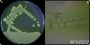 <p><b>Fig. 65:5.</b> Colonies of <i>Pseudomonas aeruginosa</i>, cultivated on Pseudomonas Isolation Agar at 37°C for 24 h. The medium contains magnesium chloride and potassium sulfate and has a low phosphorous concentration which together enhances the production of pyocyanin, a distinctive blue-green pigment<em>, </em>which<em> Pseudomonas aeriginusa</em> is the only known bacterial species to produce.</p>

<p>The scale bar is equivalent to 1 cm in image A and 3 mm in image B.</p>