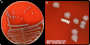 <p><b>Fig. 166:1</b>. Colonies of <i>BMorganella morganii</i>, cultivated on bovine blood agar at 37°C during 48 h. Lighting from above during photography. B is a partial close-up of A. The length of the scale bars in A and B corresponds to 1 cm and 4 mm, respectively.</p>