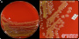 <p><strong style="color: rgb(0, 0, 0); font-family: sans-serif; font-size: 16px; font-style: normal; font-variant: normal; font-weight: 700; letter-spacing: normal; orphans: 2; text-align: left; text-decoration: none; text-indent: 0px; text-transform: none; -webkit-text-stroke-width: 0px; white-space: normal; word-spacing: 0px;">Fig 266:1.</strong><span style="background-color: rgb(221, 221, 221); color: rgb(0, 0, 0); display: inline; float: none; font-family: sans-serif; font-size: 16px; font-style: normal; font-variant: normal; font-weight: 400; letter-spacing: normal; orphans: 2; text-align: left; text-decoration: none; text-indent: 0px; text-transform: none; -webkit-text-stroke-width: 0px; white-space: normal; word-spacing: 0px;"> </span><span style="background-color: rgb(221, 221, 221); color: rgb(0, 0, 0); display: inline; float: none; font-family: sans-serif; font-size: 16px; font-style: normal; font-variant: normal; font-weight: 400; letter-spacing: normal; line-height: 1.5em; orphans: 2; text-align: left; text-decoration: none; text-indent: 0px; text-transform: none; -webkit-text-stroke-width: 0px; white-space: normal; word-spacing: 0px;">Colonies of </span><span style="display: inline !important; float: none; background-color: rgb(221, 221, 221); color: rgb(0, 0, 0); font-family: sans-serif; font-size: 16px; font-style: normal; font-variant: normal; font-weight: 400; letter-spacing: normal; line-height: 1.5em; orphans: 2; text-align: left; text-decoration: none; text-indent: 0px; text-transform: none; -webkit-text-stroke-width: 0px; white-space: normal; word-spacing: 0px;"><em>Pantoea agglomerans</em></span><span style="background-color: rgb(221, 221, 221); color: rgb(0, 0, 0); display: inline; float: none; font-family: sans-serif; font-size: 16px; font-style: normal; font-variant: normal; font-weight: 400; letter-spacing: normal; orphans: 2; text-align: left; text-decoration: none; text-indent: 0px; text-transform: none; -webkit-text-stroke-width: 0px; white-space: normal; word-spacing: 0px;">, </span><span style="background-color: rgb(221, 221, 221); color: rgb(0, 0, 0); display: inline; float: none; font-family: sans-serif; font-size: 16px; font-style: normal; font-variant: normal; font-weight: 400; letter-spacing: normal; line-height: 1.5em; orphans: 2; text-align: left; text-decoration: none; text-indent: 0px; text-transform: none; -webkit-text-stroke-width: 0px; white-space: normal; word-spacing: 0px;">cultured aerobically on bovine blood agar at 37°C during 24 h.<span style="background-color: rgb(221, 221, 221); color: rgb(0, 0, 0); display: inline; float: none; font-family: sans-serif; font-size: 16px; font-style: normal; font-variant: normal; font-weight: 400; letter-spacing: normal; orphans: 2; text-align: left; text-decoration: none; text-indent: 0px; text-transform: none; -webkit-text-stroke-width: 0px; white-space: normal; word-spacing: 0px;"> </span>The length of the scale bars in A and B is equivalent to 3 mm.</span><span style="background-color: rgb(221, 221, 221); color: rgb(0, 0, 0); display: inline; float: none; font-family: sans-serif; font-size: 16px; font-style: normal; font-variant: normal; font-weight: 400; letter-spacing: normal; orphans: 2; text-align: left; text-decoration: none; text-indent: 0px; text-transform: none; -webkit-text-stroke-width: 0px; white-space: normal; word-spacing: 0px;">Datum: 2024-10-24</span></p>

<p><span style="background-color: rgb(221, 221, 221); color: rgb(0, 0, 0); display: inline; float: none; font-family: sans-serif; font-size: 16px; font-style: normal; font-variant: normal; font-weight: 400; letter-spacing: normal; orphans: 2; text-align: left; text-decoration: none; text-indent: 0px; text-transform: none; -webkit-text-stroke-width: 0px; white-space: normal; word-spacing: 0px;">.</span></p>