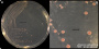 <p><strong>Fig 260:1.</strong> Colonies of <em>Enterococcus hirae</em>, cultured aerobically on Slanetz and Bartley-agar (SlaBa-agar) at 37°C during 24 h. The lengths of the scale bars in A and B are equivalent to 10 and 3 mm, respectively.</p>

<p>Date: 2026-03-09</p>