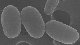 Paenibacillus larvae